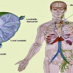 Lenfoma Nedir? Lenfoma Kanseri Belirtileri Nelerdir?