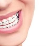 Diş Teli Fiyatları 2024 Yılı Düzenlemeleri